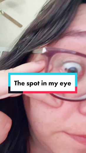 Understanding Eye Birthmarks: Causes and Removal Options