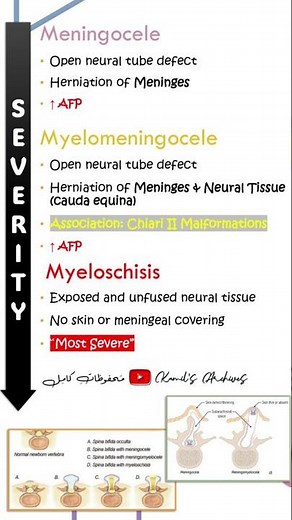 NTD: Meningocele, Myelomeningocele, Myeloschisis #neurology #medical #medschool #embryology #usmle