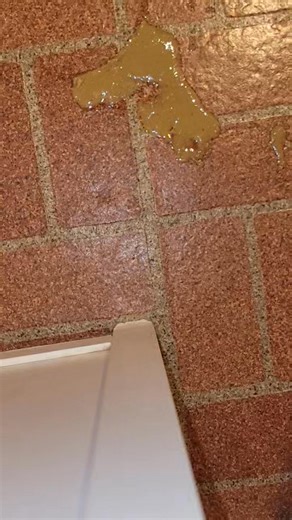 How I keep my fingers clean when cleaning up cat puke. Yes, I have a technique. And it works well for me. [smartphone] Wee3beasties: Saving the Strays | Wee3beasties: Saving the Strays