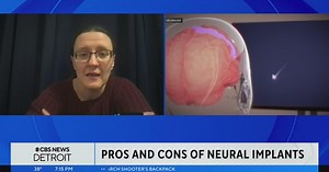 What are the pros and cons of neural implants?