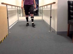 Charcot Marie Tooth - Walking in Bilateral Dynamic GRAFO