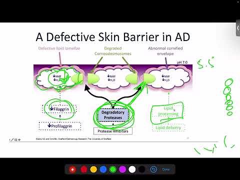 Pathogenesis of Atopic Dermatitis