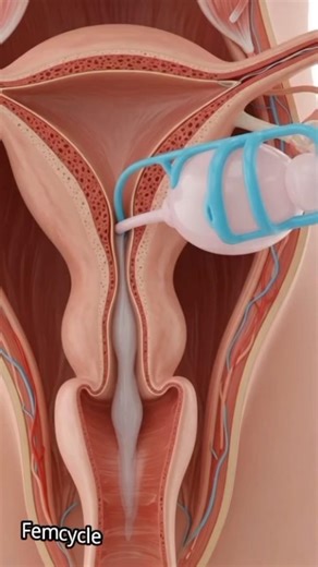 “How the Uterus Responds to Medical Dilation | Real-Time 3D Anatomy”