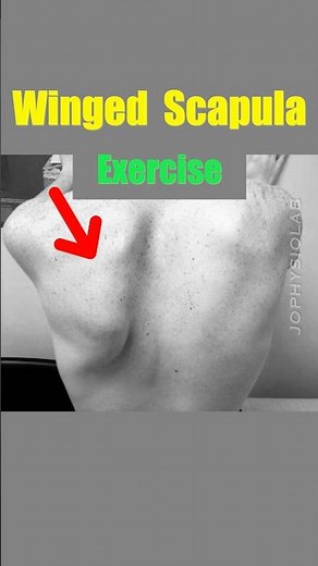Exercise to fix Winged Scapula. #shoulderblade #thoracicoutletsyndrome #shoulderpain