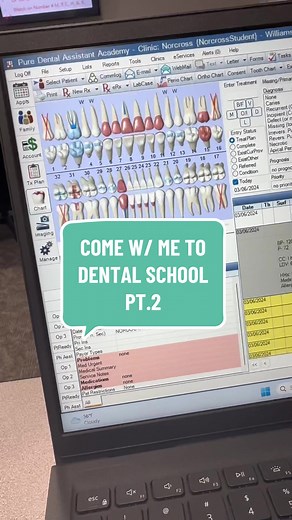 part 2 | another day at dental school - charting on open dental 😬🪥🦷 #mintdentistry #dentistry #dental #dentalassistant #dentalassistantlife #dentalstudent #opendental #newcareer #fyp #fypシ #foryou #viral #trending