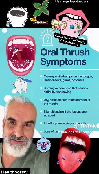Effective Oregano Oil Mouth Rinse for Oral Thrush Relief