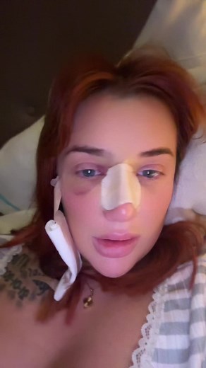 Day 2 Post-Op Recovery Insights