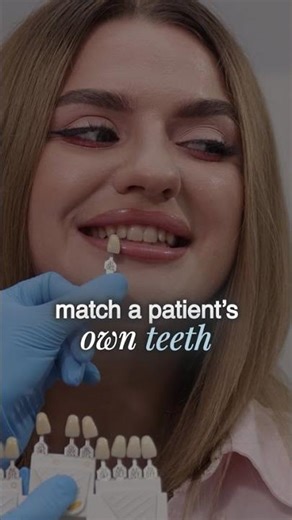 How We Match Your Tooth Color Naturally | Compassionate Cosmetic Dentistry 💛