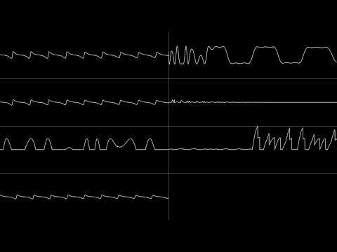Street Life (YM3812)
