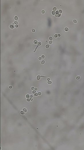 Germ tube test -Positive Candida albicans #shorts