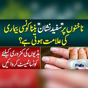 28K views · 182 reactions | White Spots On Nails Reason - Nail signs of Disease - Half Moon On Nails Causes - Nakhun Par Safed Nishan Ka Matlab - Leukonychia Treatment #WhiteSpotsOnNails #NailProblems #LeukonychiaTreatment #VitaminDeficiency | Sehat Mand - Health & Lifestyle | Facebook