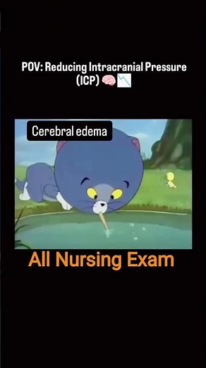 Cerebral edema