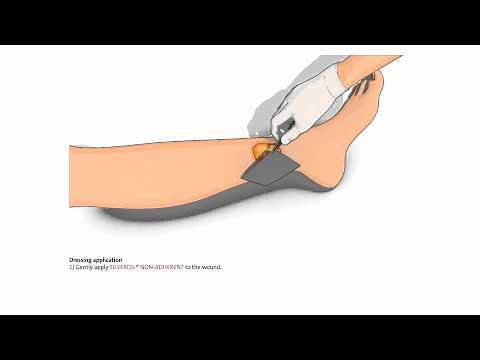 SILVERCEL™ Non-Adherent Hydro-Alginate Antimicrobial Dressing with Silver - How to use