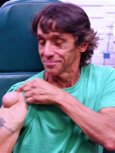 Understanding Shoulder Cysts: Causes and Treatments