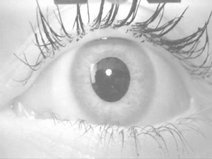 File:Smooth pursuit eye movements.webm - Wikimedia Commons