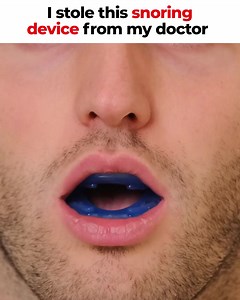 498K views · 6.5K reactions | Snoring was ruining my relationship......