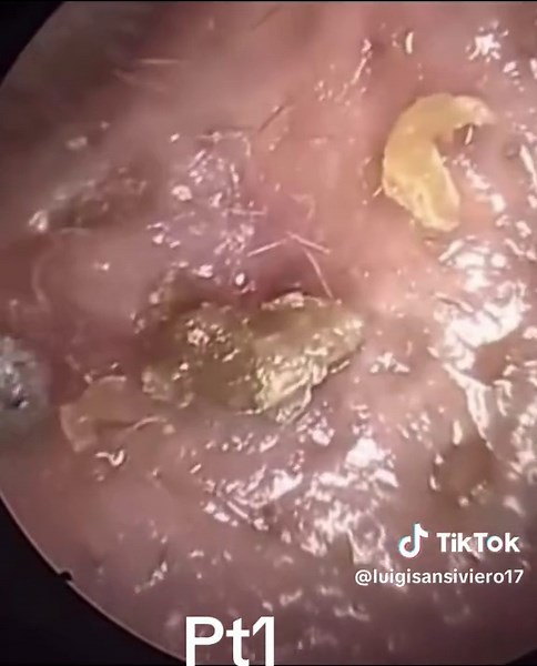 Understanding Skin Infections: Causes and Treatments