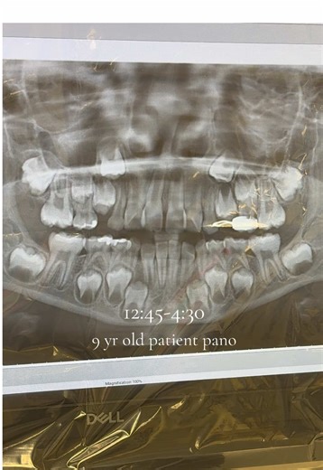 First Week of Pediatric Dentistry Rotation Insights