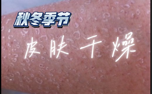 冬季皮肤干燥的原因