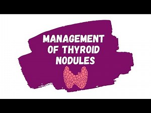 Management of Thyroid Nodules | ALGORITHM