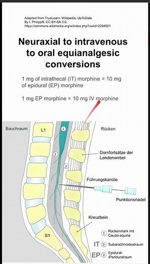 Neuraxial to intravenous to oral equianalgesic conversions