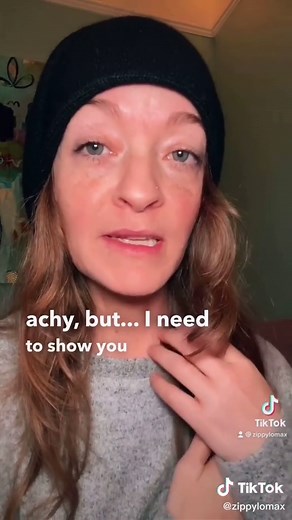 Understanding Port Placement for Breast Cancer Treatment