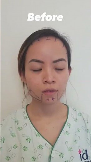 Full Face Transformation