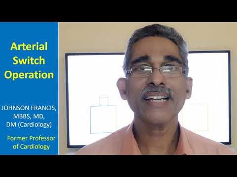 Arterial Switch Operation