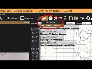 Arc 3.2 Multi-Camera Setup | Step 4: Multi-Camera Video Recording