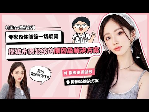 【韩国DA整形】提线木偶皱纹的原因及解决方案——专家为你解答一切疑问！