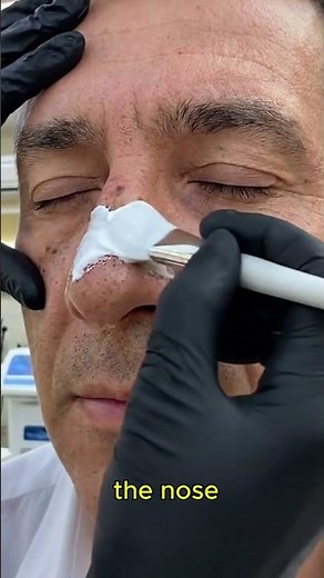 Nose & Surrounding Pore Treatment for Men #skincare #skin #beauty #skincareroutine