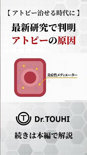【アトピー性皮膚炎治せる時代に】アトピーが発症する仕組み