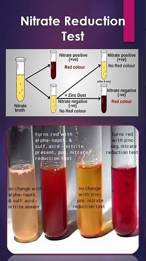 Nitrate Reduction Test