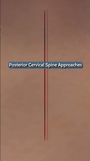 Posterior Cervical Corridor & Surgical Techniques: A Surgeon's Guide #Shorts