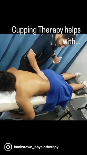 5.6K views · 61 reactions | The benefits of Cupping Therapy include...