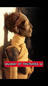 Mummy of Thutmose IV – Scientific Evidence of Illness, Belief, and Royal Burial Practices The mummy of King Thutmose IV offers a rare and scientifically significant insight into the physical condition, funerary ideology, and medical realities of Egypt’s New Kingdom rulers. Discovered in 1898 within the Royal Mummy Cache at KV35 by Victor Loret, the king’s body had been relocated in antiquity by ancient priests, a protective measure taken during periods of tomb robbery to safeguard royal remains.