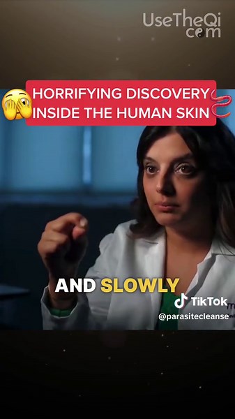 I never expected to pull a live thing out of a hole in my skin, but that's exactly what happened! #insect #insectinfestation #grossout #larvaeremoval #forceps #livingthing #wriggling #horrorstory #medicaltok @The Qi Master ⭐️ David Wong