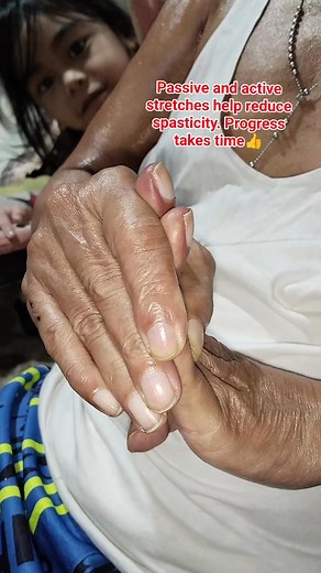 #stroketherapy #HandStrength #perseverance | Melody Zita Aberilla