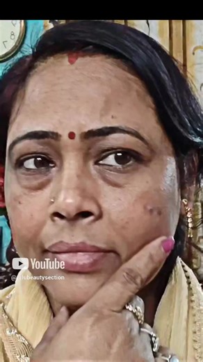 44K views · 360 reactions | 2 महिने के इस्तेमाल से चेहरे की 5 साल...