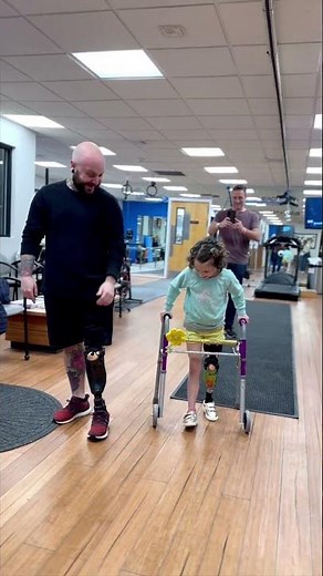 Belle's Rotationplasty Experience: Insightful Lessons from a Seasoned Amputee