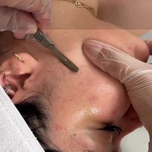 1.1K reactions · 183 shares | Crepey skin that looks like tissue-paper can appear almost anywhere on the body. The neck, the hands, the legs, the knees, the chest can all thin and crepe so Harvard-educated dermatologist, Dr. Manjula Jegasothy wants to share a new method to help smooth and firm it out. See how Advanced Crepe Fix works by watching this short presentation today. | Miami MD | Facebook