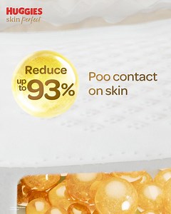 6.5K views · 16 reactions | Runny Poo AND Pee? We got you, baby! NEW Huggies Skin Perfect Technology has two absorbent zones to keep baby's delicate skin dry. #HuggiesSkinPerfectTechnology #HuggiesPH #WeGotYouBaby | Huggies PH | Facebook