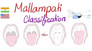 14 reactions | Mallampati Score (Classification) for Airway Management…Endotracheal Intubation. | Medicosis Perfectionalis | Facebook
