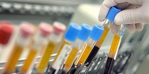 How does drug testing work?