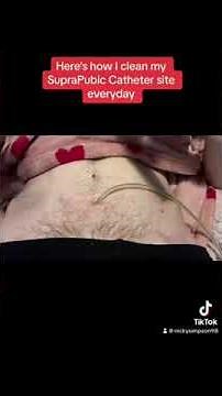 Here’s how I change the dressing around my suprapubic catheter