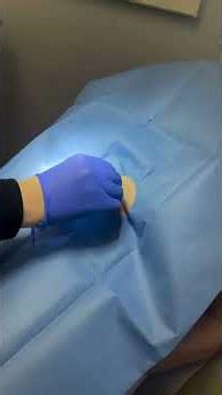 Dermatologist Performs a Punch Biopsy | Quick In-Office Skin Sampling