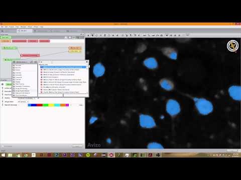 Avizo 9.0: 4.2 Hysteresis Thresholding, and Watershed Transforms.
