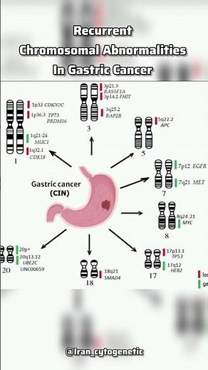 Gastric Cancer Chromosomal Instability /#biology #genetics #cancer