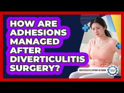 How Are Adhesions Managed After Diverticulitis Surgery?