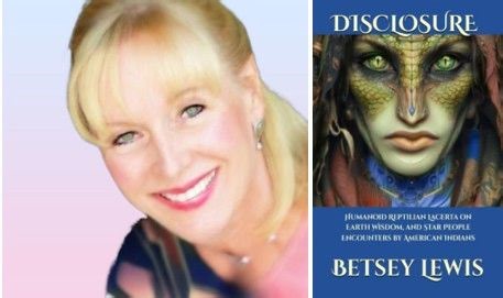 Part 2 Lacerta's Interview from Betsey's book, DISCLOSURE